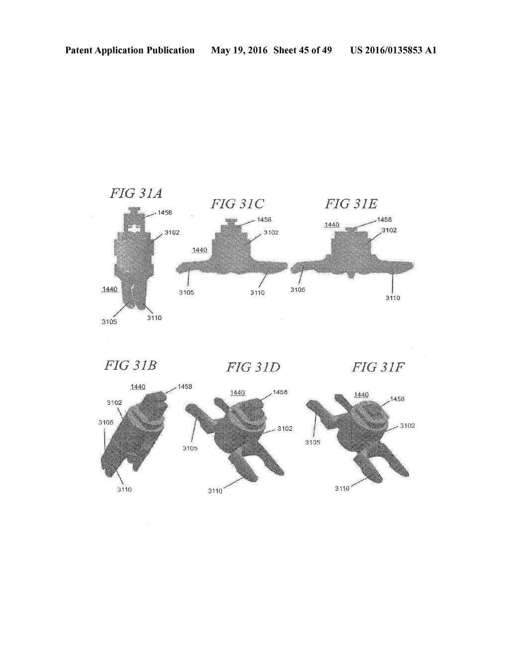 MINIMALLY INVASIVE TOOLING FOR DELIVERY OF INTERSPINOUS SPACER - diagram, schematic, and image 46