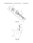 BONE ANCHORS AND SURGICAL INSTRUMENTS WITH INTEGRATED GUIDE TIPS diagram and image