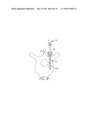 BONE ANCHORS AND SURGICAL INSTRUMENTS WITH INTEGRATED GUIDE TIPS diagram and image