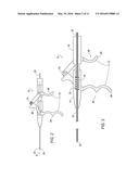 ELECTROSURGICAL ELECTRODE diagram and image