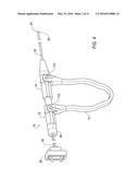 ELECTROSURGICAL ELECTRODE diagram and image