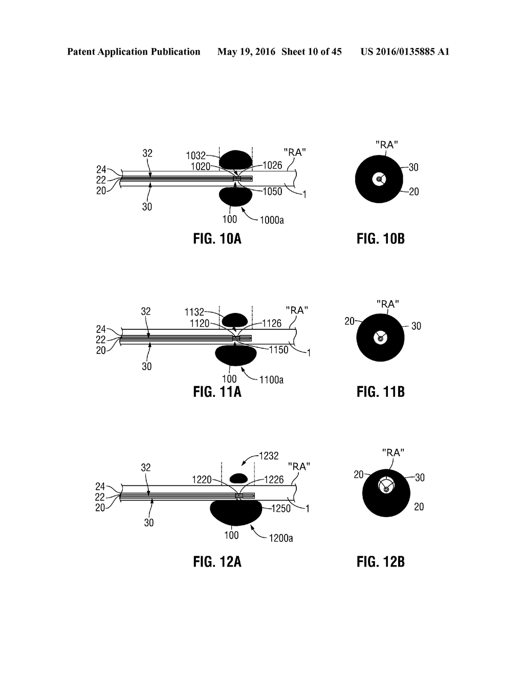 FLEXIBLE MICROWAVE CATHETERS FOR NATURAL OR ARTIFICIAL LUMENS - diagram, schematic, and image 11