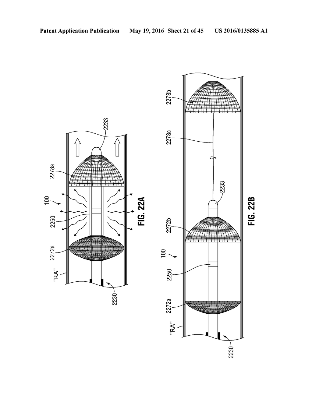 FLEXIBLE MICROWAVE CATHETERS FOR NATURAL OR ARTIFICIAL LUMENS - diagram, schematic, and image 22