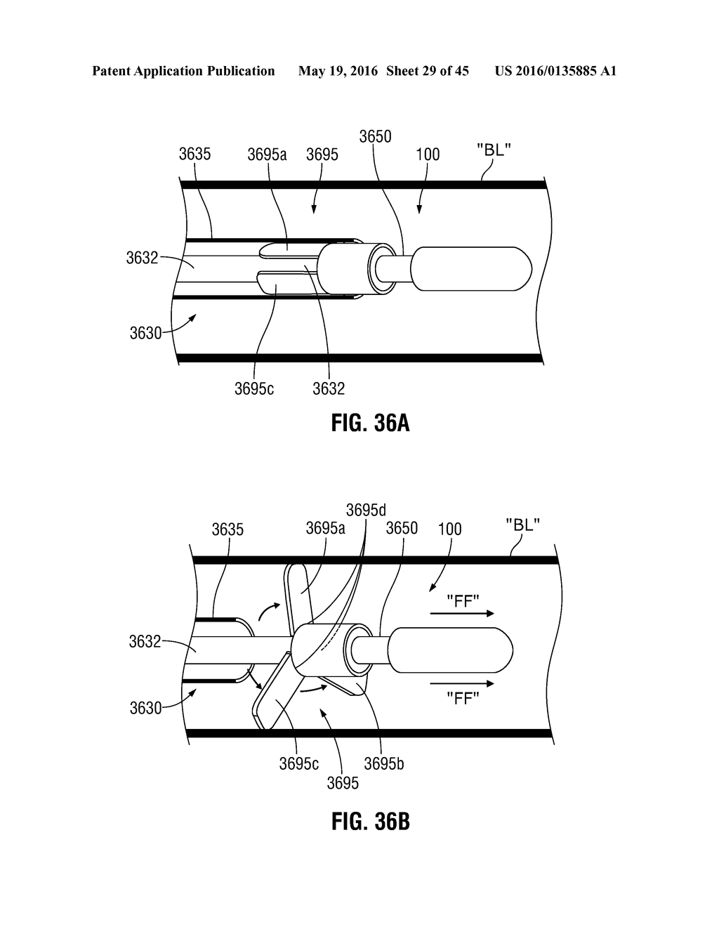 FLEXIBLE MICROWAVE CATHETERS FOR NATURAL OR ARTIFICIAL LUMENS - diagram, schematic, and image 30