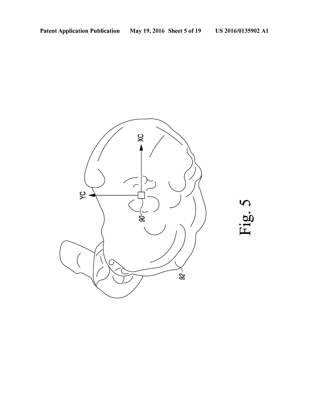 APPARATUS AND METHOD FOR CALIBRATING AN X-RAY IMAGE OF A KNEE OF A PATIENT - diagram, schematic, and image 06