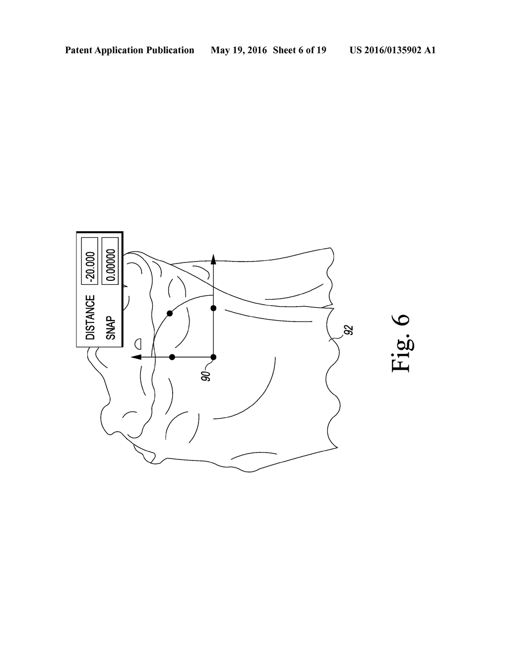 APPARATUS AND METHOD FOR CALIBRATING AN X-RAY IMAGE OF A KNEE OF A PATIENT - diagram, schematic, and image 07