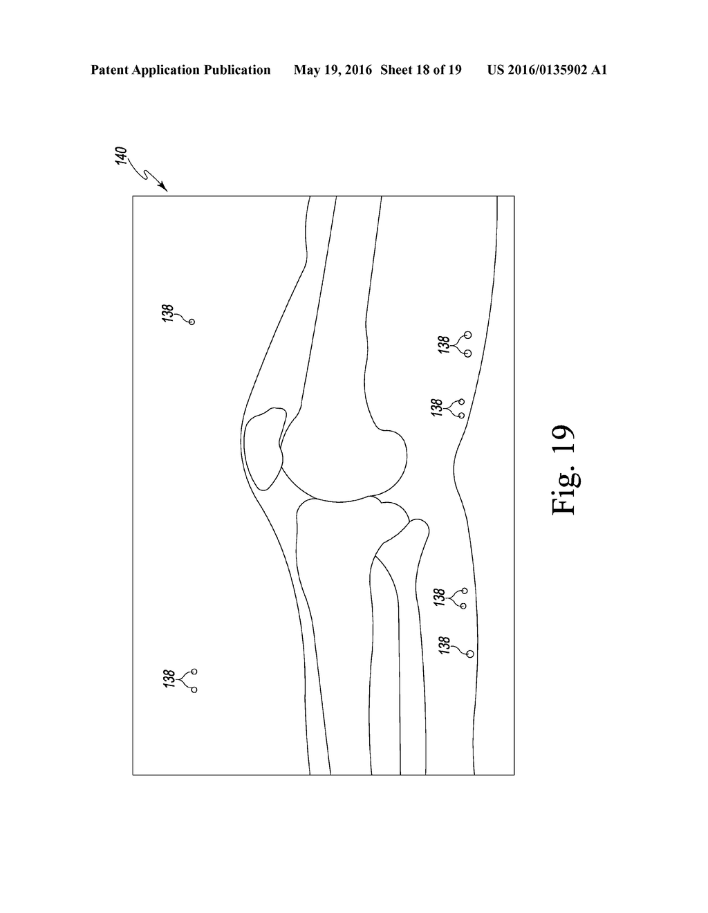 APPARATUS AND METHOD FOR CALIBRATING AN X-RAY IMAGE OF A KNEE OF A PATIENT - diagram, schematic, and image 19