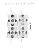 DENTAL APPLIANCE WITH CAVITY FOR AN UNERUPTED OR ERUPTING TOOTH diagram and image