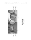 DENTAL APPLIANCE WITH CAVITY FOR AN UNERUPTED OR ERUPTING TOOTH diagram and image