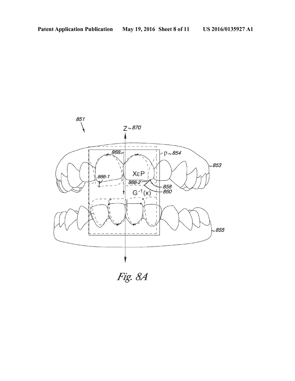 DIGITAL DENTAL MODELING - diagram, schematic, and image 09