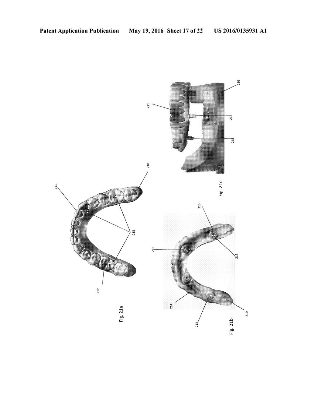 APPARATUS AND METHODS OF MAKING DENTURE DEVICES - diagram, schematic, and image 18