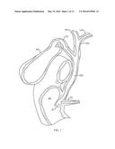 BILIARY STENTS AND METHODS diagram and image