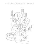 BILIARY STENTS AND METHODS diagram and image