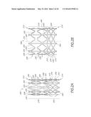 DELIVERY SYSTEM FOR VASCULAR IMPLANT diagram and image