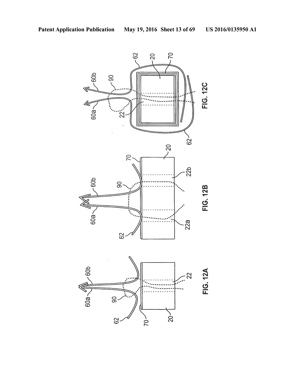 COLLAPSIBLE PROSTHETIC HEART VALVES - diagram, schematic, and image 14