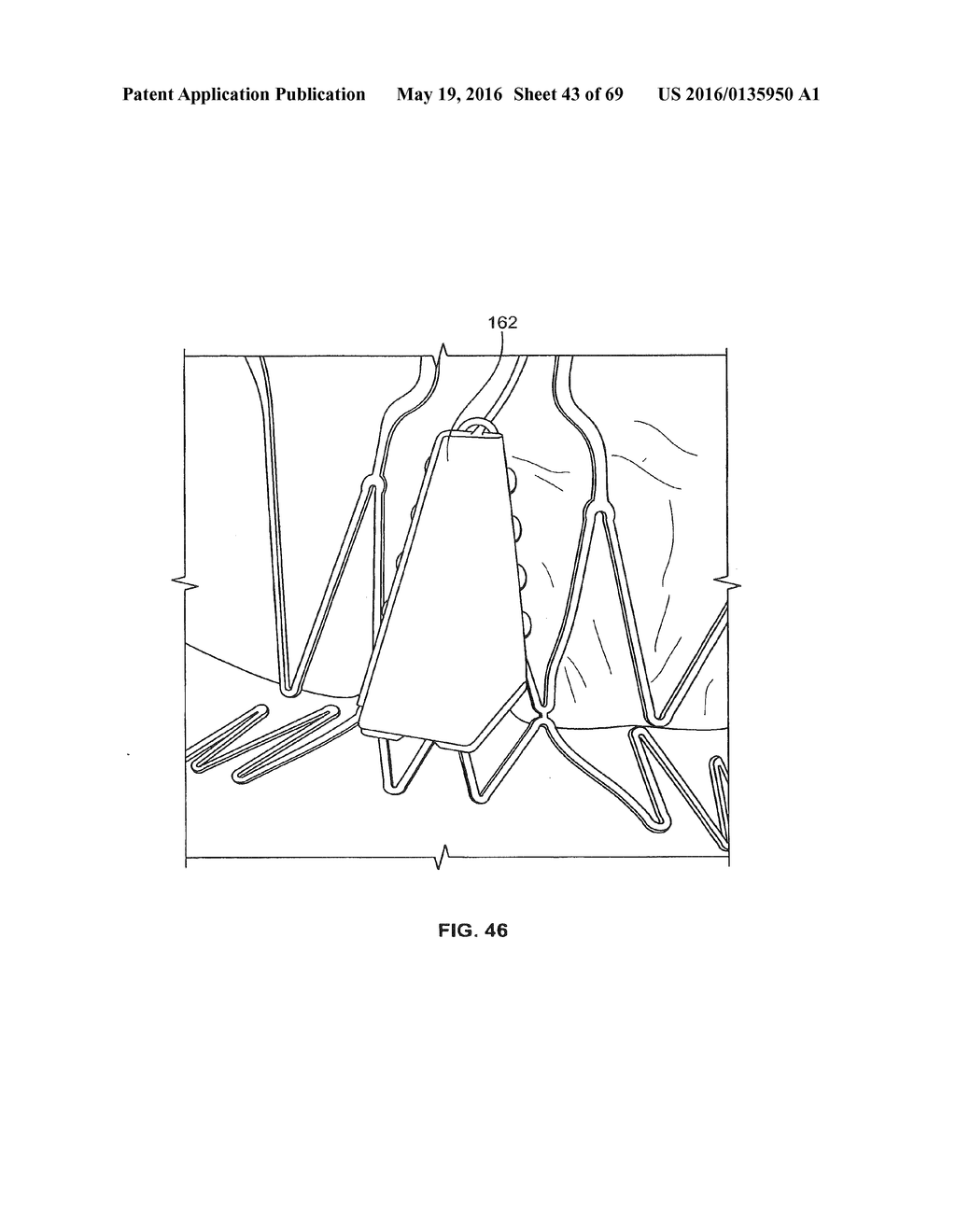 COLLAPSIBLE PROSTHETIC HEART VALVES - diagram, schematic, and image 44