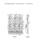 LOW PROFILE HEART VALVE AND DELIVERY SYSTEM diagram and image