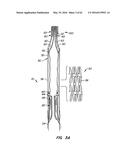 LOW PROFILE HEART VALVE AND DELIVERY SYSTEM diagram and image