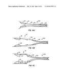 LOW PROFILE HEART VALVE AND DELIVERY SYSTEM diagram and image