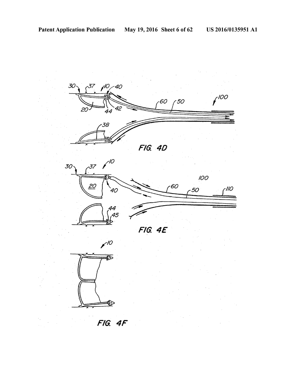 LOW PROFILE HEART VALVE AND DELIVERY SYSTEM - diagram, schematic, and image 07