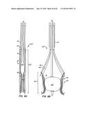 LOW PROFILE HEART VALVE AND DELIVERY SYSTEM diagram and image