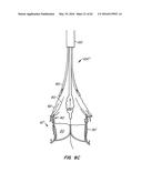 LOW PROFILE HEART VALVE AND DELIVERY SYSTEM diagram and image