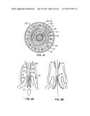 LOW PROFILE HEART VALVE AND DELIVERY SYSTEM diagram and image