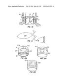 LOW PROFILE HEART VALVE AND DELIVERY SYSTEM diagram and image