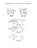 LOW PROFILE HEART VALVE AND DELIVERY SYSTEM diagram and image