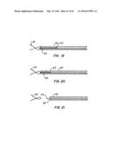 LOW PROFILE HEART VALVE AND DELIVERY SYSTEM diagram and image