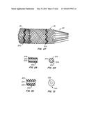 LOW PROFILE HEART VALVE AND DELIVERY SYSTEM diagram and image