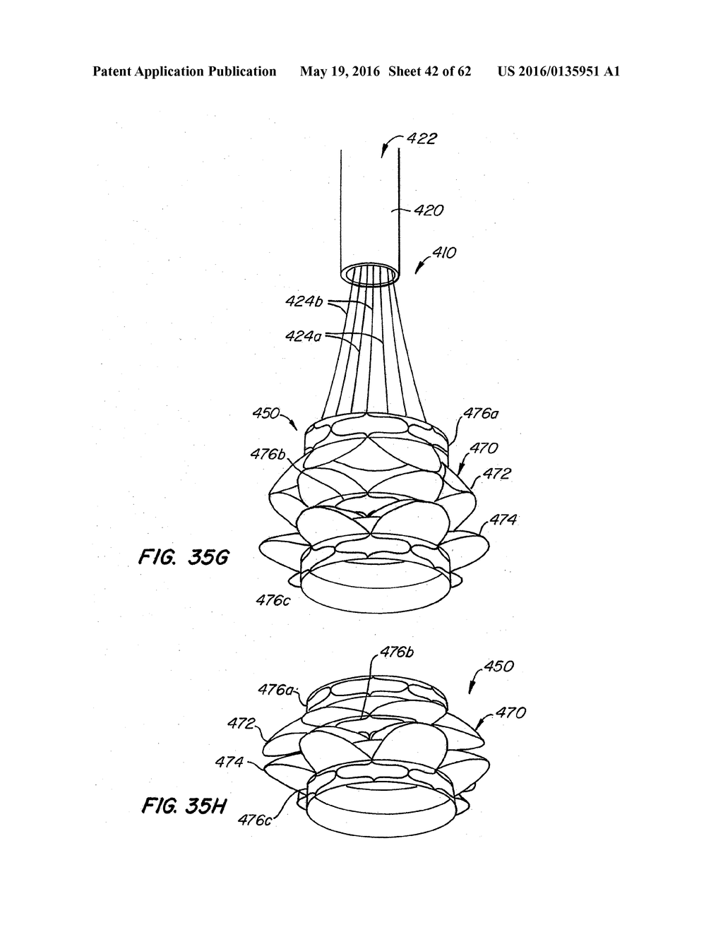 LOW PROFILE HEART VALVE AND DELIVERY SYSTEM - diagram, schematic, and image 43