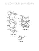 LOW PROFILE HEART VALVE AND DELIVERY SYSTEM diagram and image