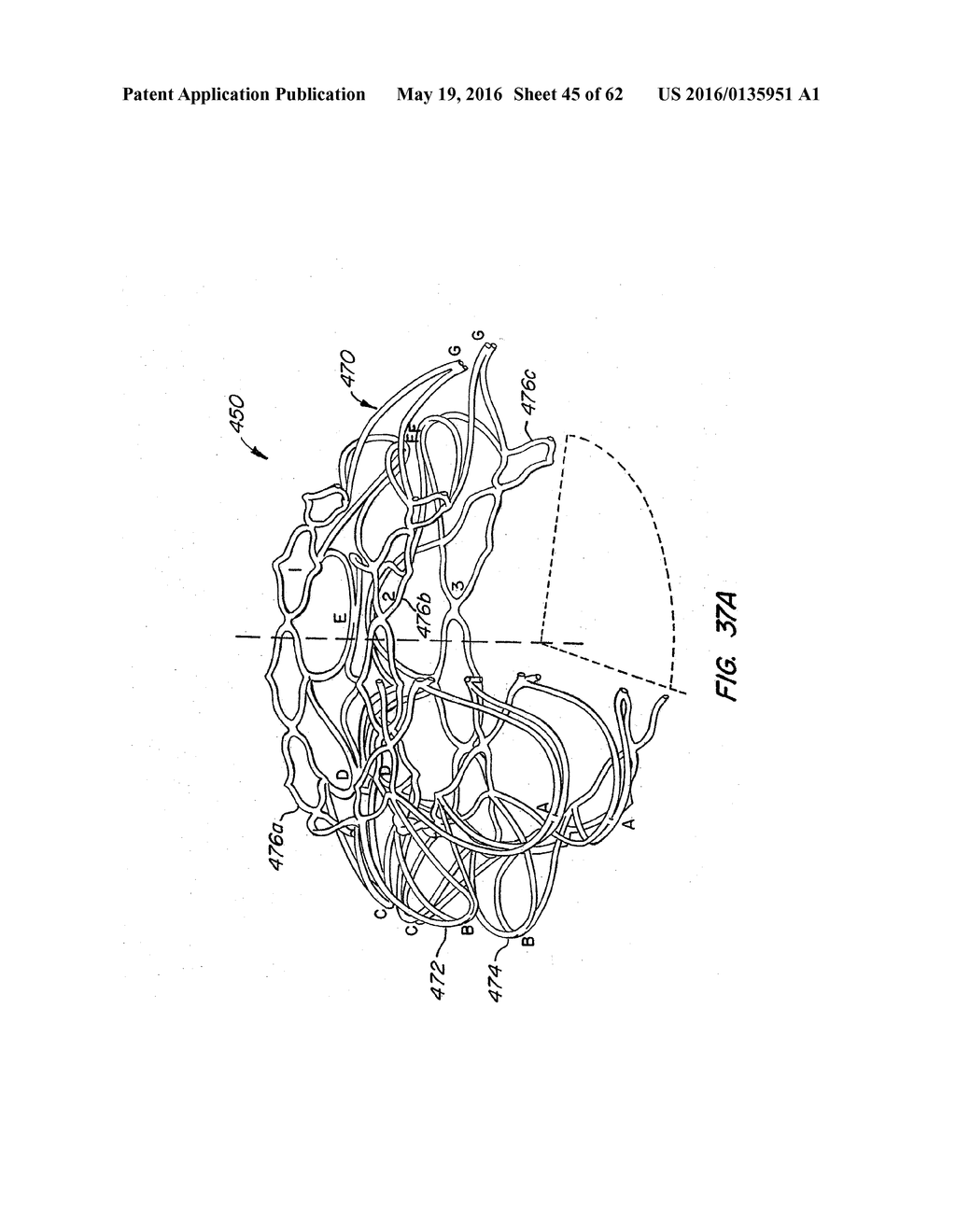 LOW PROFILE HEART VALVE AND DELIVERY SYSTEM - diagram, schematic, and image 46