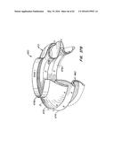 LOW PROFILE HEART VALVE AND DELIVERY SYSTEM diagram and image