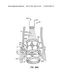 LOW PROFILE HEART VALVE AND DELIVERY SYSTEM diagram and image