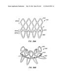 LOW PROFILE HEART VALVE AND DELIVERY SYSTEM diagram and image