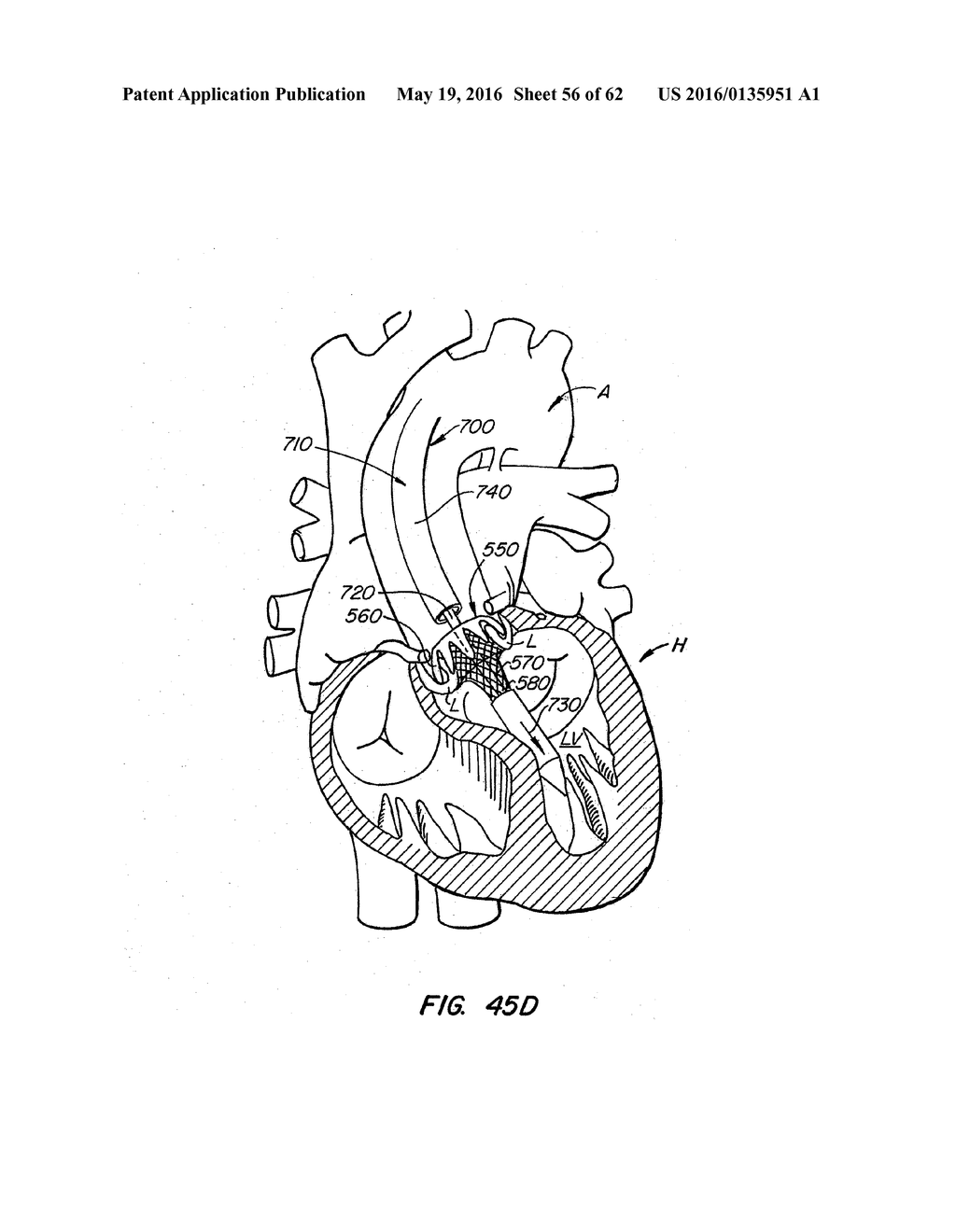 LOW PROFILE HEART VALVE AND DELIVERY SYSTEM - diagram, schematic, and image 57