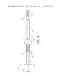 MILLED BONE GRAFT MATERIALS AND METHODS OF USE diagram and image