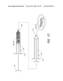 MILLED BONE GRAFT MATERIALS AND METHODS OF USE diagram and image