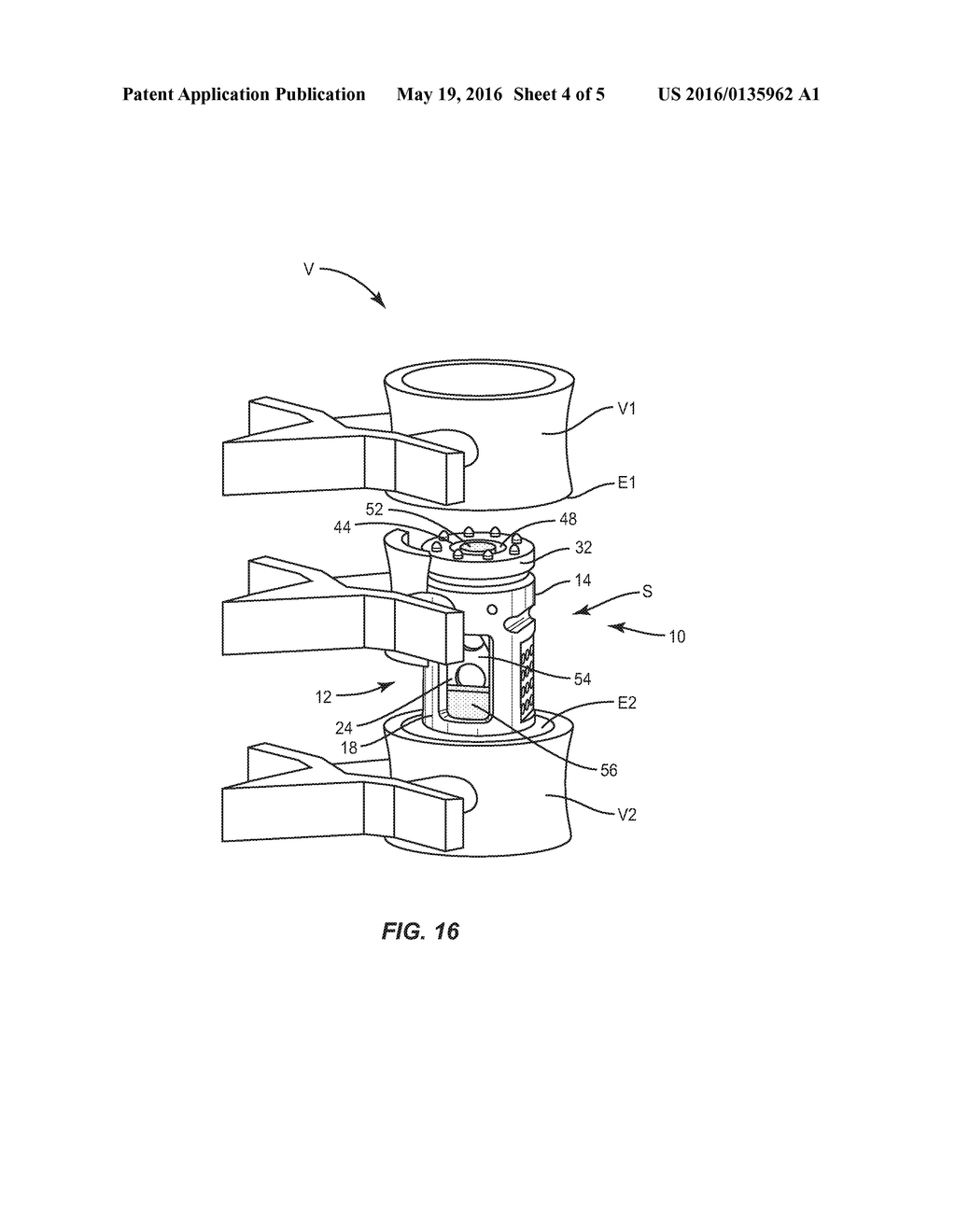 EXPANDABLE SPINAL IMPLANT SYSTEM AND METHOD - diagram, schematic, and image 05