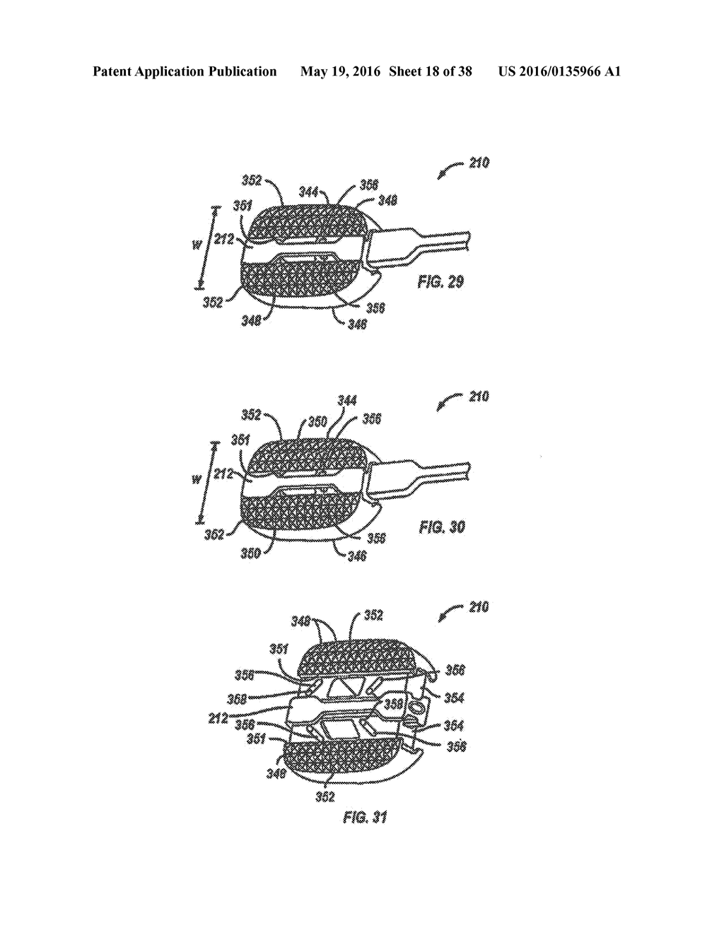 EXPANDABLE FUSION DEVICE AND METHOD OF INSTALLATION THEREOF - diagram, schematic, and image 19