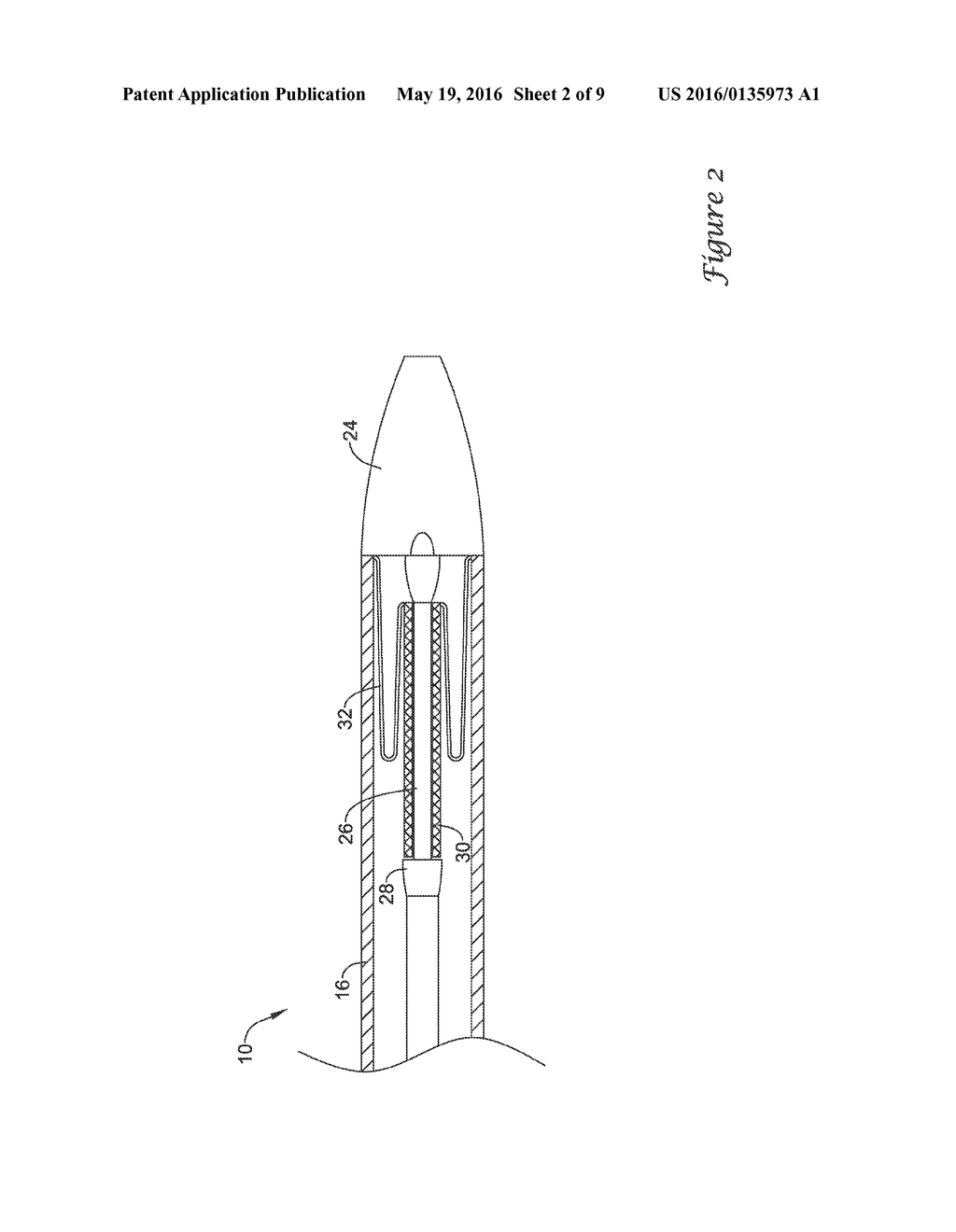 STENT DELIVERY SYSTEMS WITH A RECONSTRAINING MEMBER - diagram, schematic, and image 03