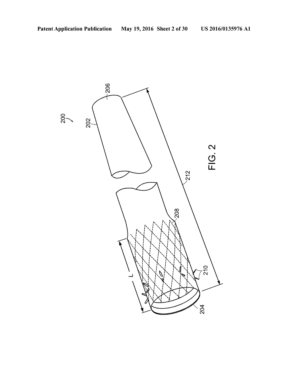 Methods Of Treatment Using A Bariatric Sleeve - diagram, schematic, and image 03