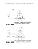 CPR CHEST COMPRESSION MACHINE ADJUSTING MOTION-TIME PROFILE IN VIEW OF     DETECTED FORCE diagram and image