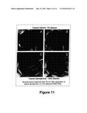 TOPICAL VASOCONSTRICTOR PREPARATIONS AND METHODS FOR PROTECTING CELLS     DURING CANCER CHEMOTHERAPY AND RADIOTHERAPY diagram and image