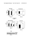 Methods and Compositions for the Treatment of Cancer and Related     Hyperproliferative Disorders diagram and image