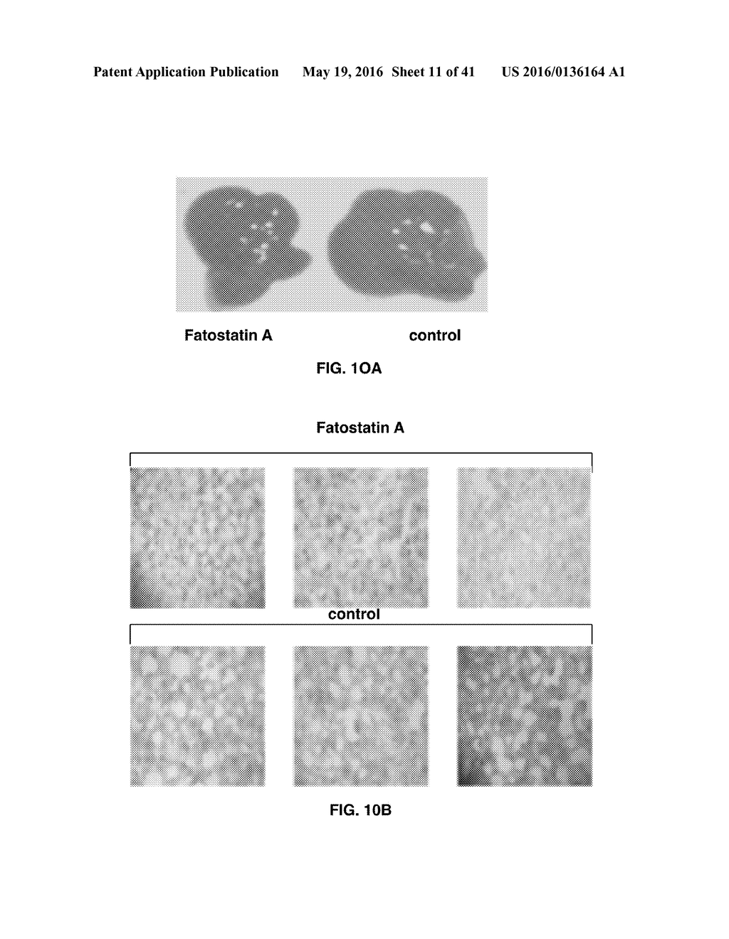 Methods and Compositions for the Treatment of Cancer and Related     Hyperproliferative Disorders - diagram, schematic, and image 12