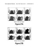 Molecular and Herbal Combinations for Treating Psoriasis diagram and image