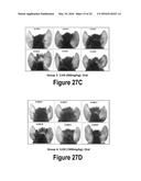 Molecular and Herbal Combinations for Treating Psoriasis diagram and image